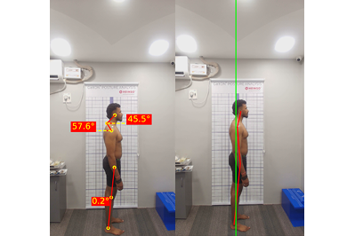 Customized Rehab Program